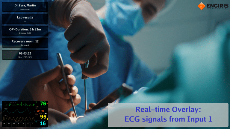 Video of Operation Taking Place with Dynamic Overlays showing patient information and Picture-In-Picture an Electrocardiograph input on the second SDI input